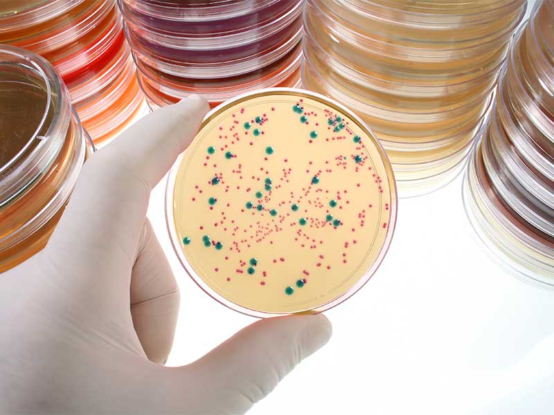 Dehydrated culture media(DCM) for microbial growth