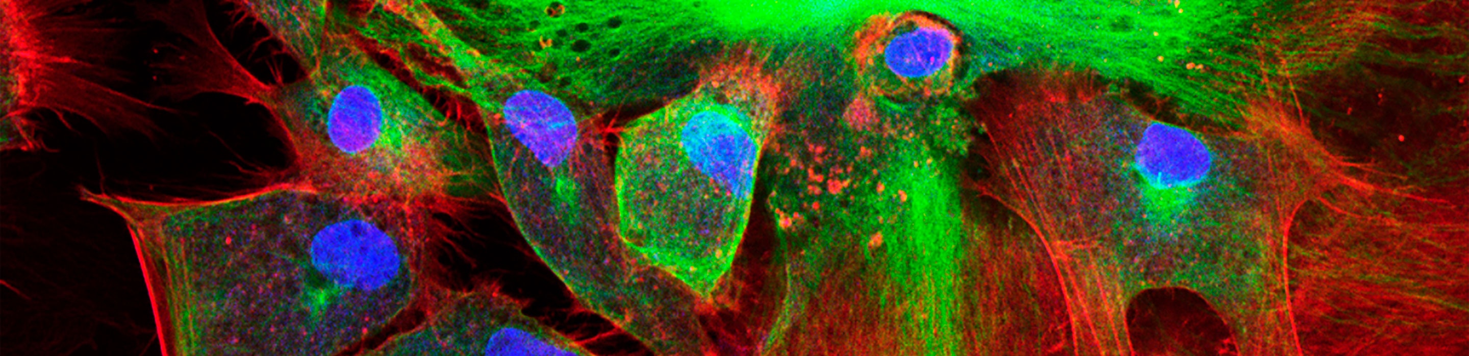 Managing Autofluorescence Banner