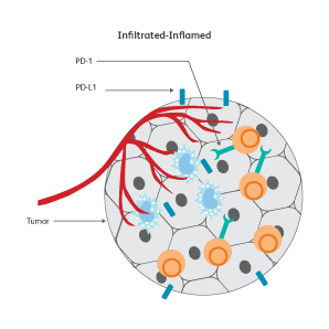 Diagram showing inflamed tumor cells. Diagram showing inflamed tumor cells.