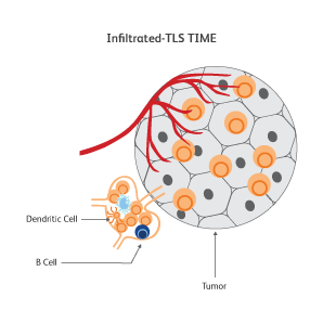 Diagram showing a dendritic cell and B cell infiltrating a tumor. Diagram showing a dendritic cell and B cell infiltrating a tumor.