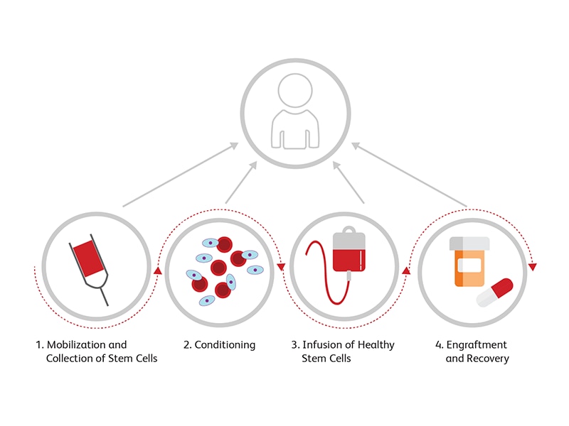 Diagram showing steps for stem cell collection and transplantation process. Diagram showing steps for stem cell collection and transplantation process.