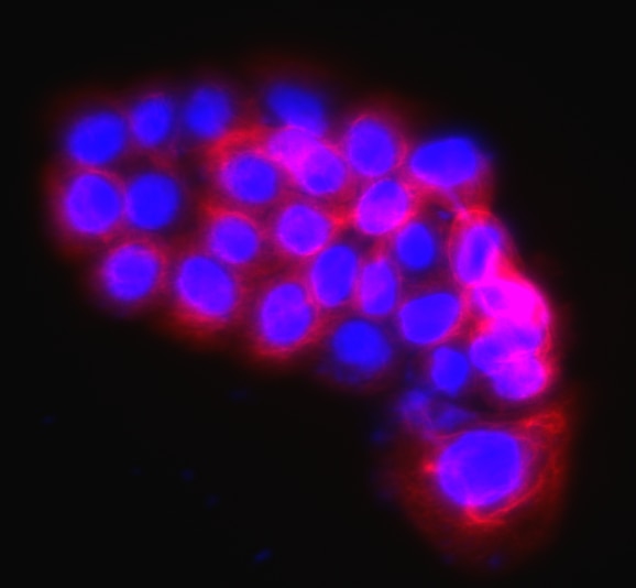 Alexa Fluor® 647 Mouse Anti-Human Cytokeratin 14, 15, 16 and 19