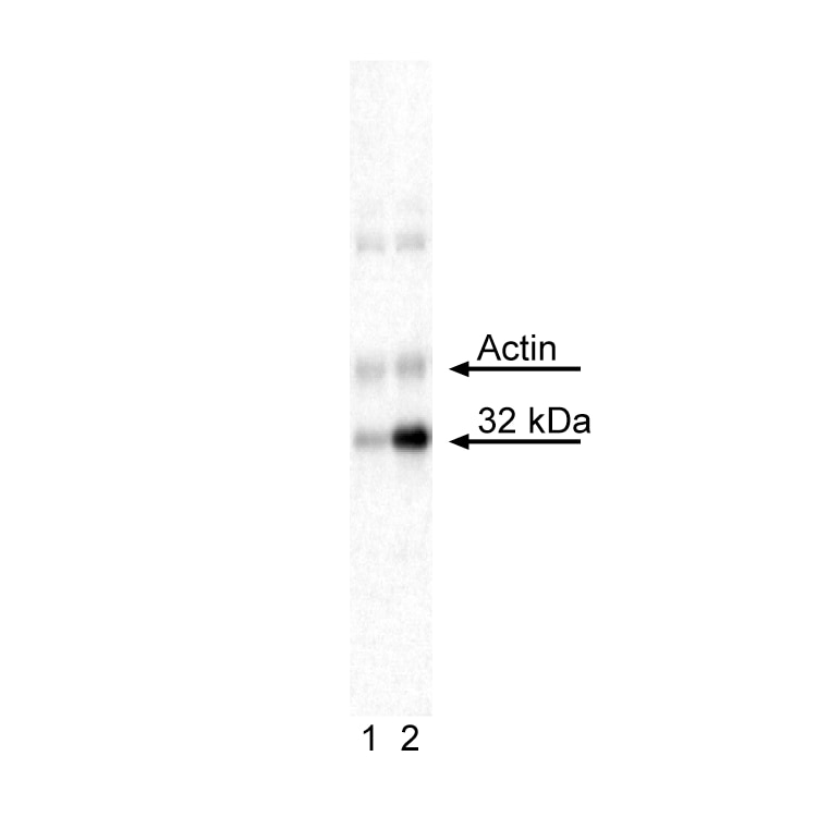 S6_pS244_BLOT.png