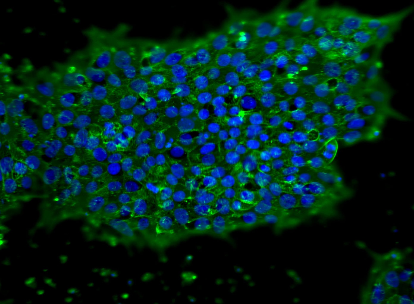 ssea5_025_a488_Dapi.png