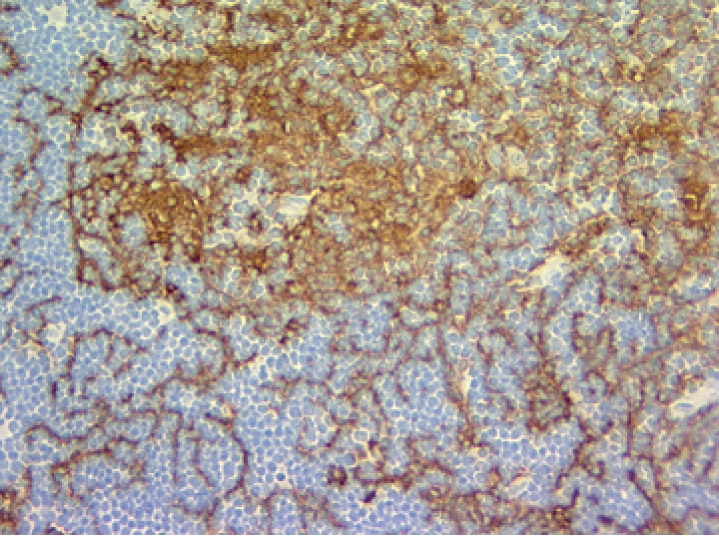 Biotin Mouse Anti-Mouse I-A[d]