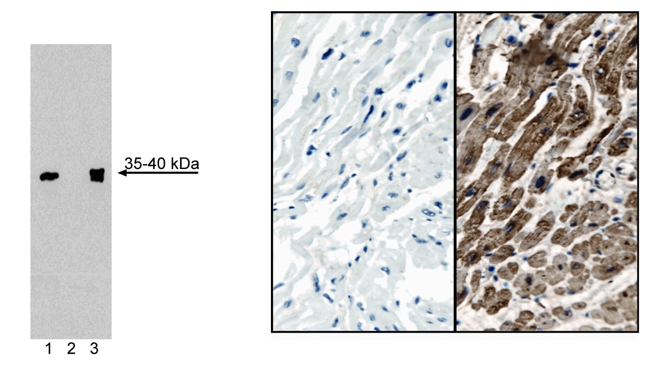 Purified Mouse Anti-Cardiac Troponin T