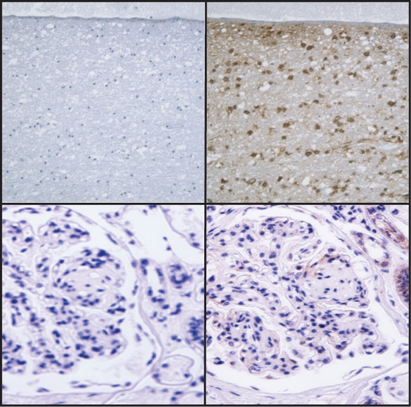 Purified Mouse Anti-Human Podocalyxin Associated Keratan Sulfate