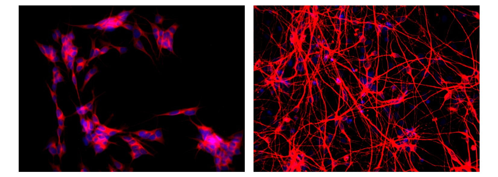 Alexa Fluor® 555 Mouse anti-β-Tubulin, Class III