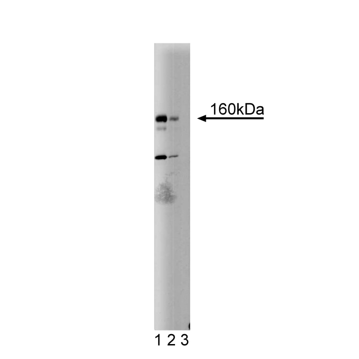 Purified Mouse Anti-Human DAP Kinase