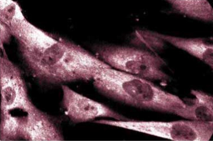 Purified Mouse Anti-Human DAP Kinase