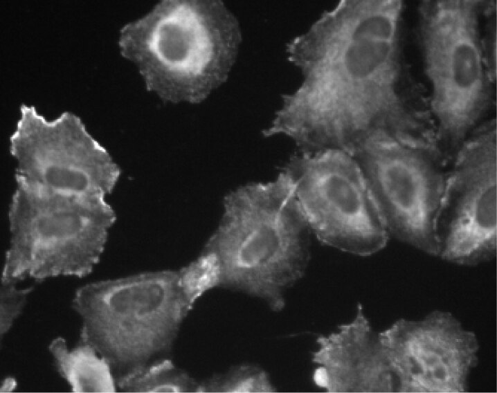 Purified Mouse Anti-Human PI3-Kinase C2β