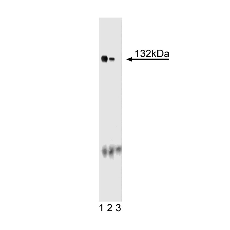 Purified Mouse Anti-Ceruloplasmin
