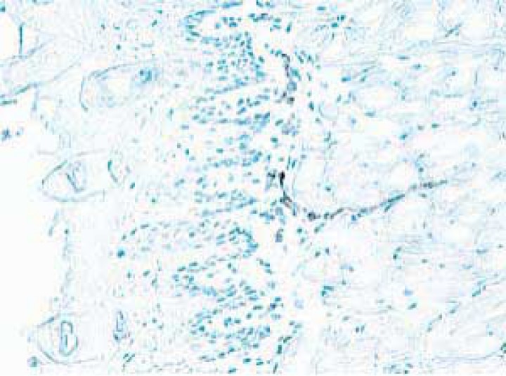 Purified Rat Anti-Mouse CD62E