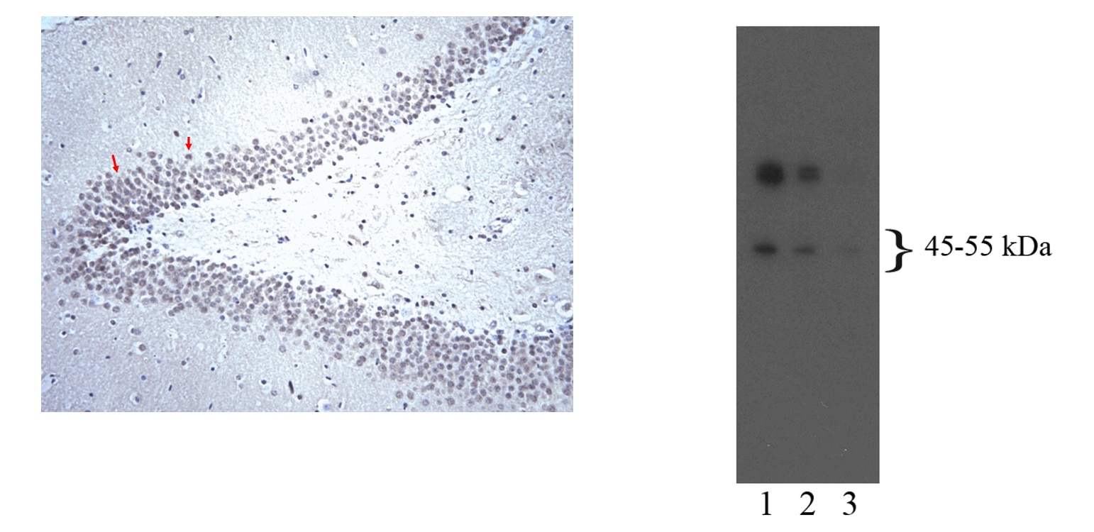 Purified Mouse Anti-Serotonin Receptor 5-HT[2B]R
